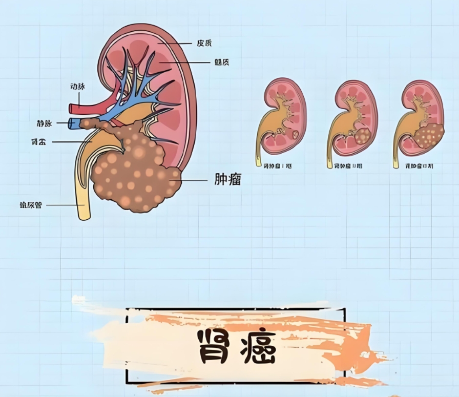 微信截图_20250624103428.png
